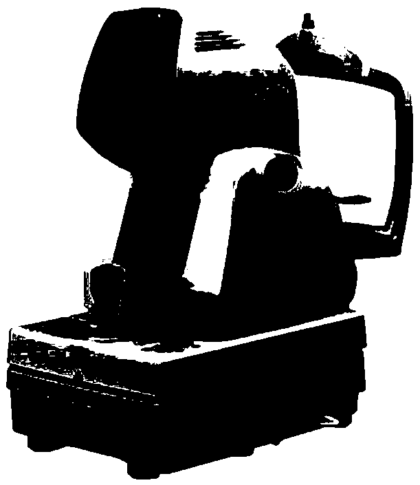 System for screening diabetic retinopathy