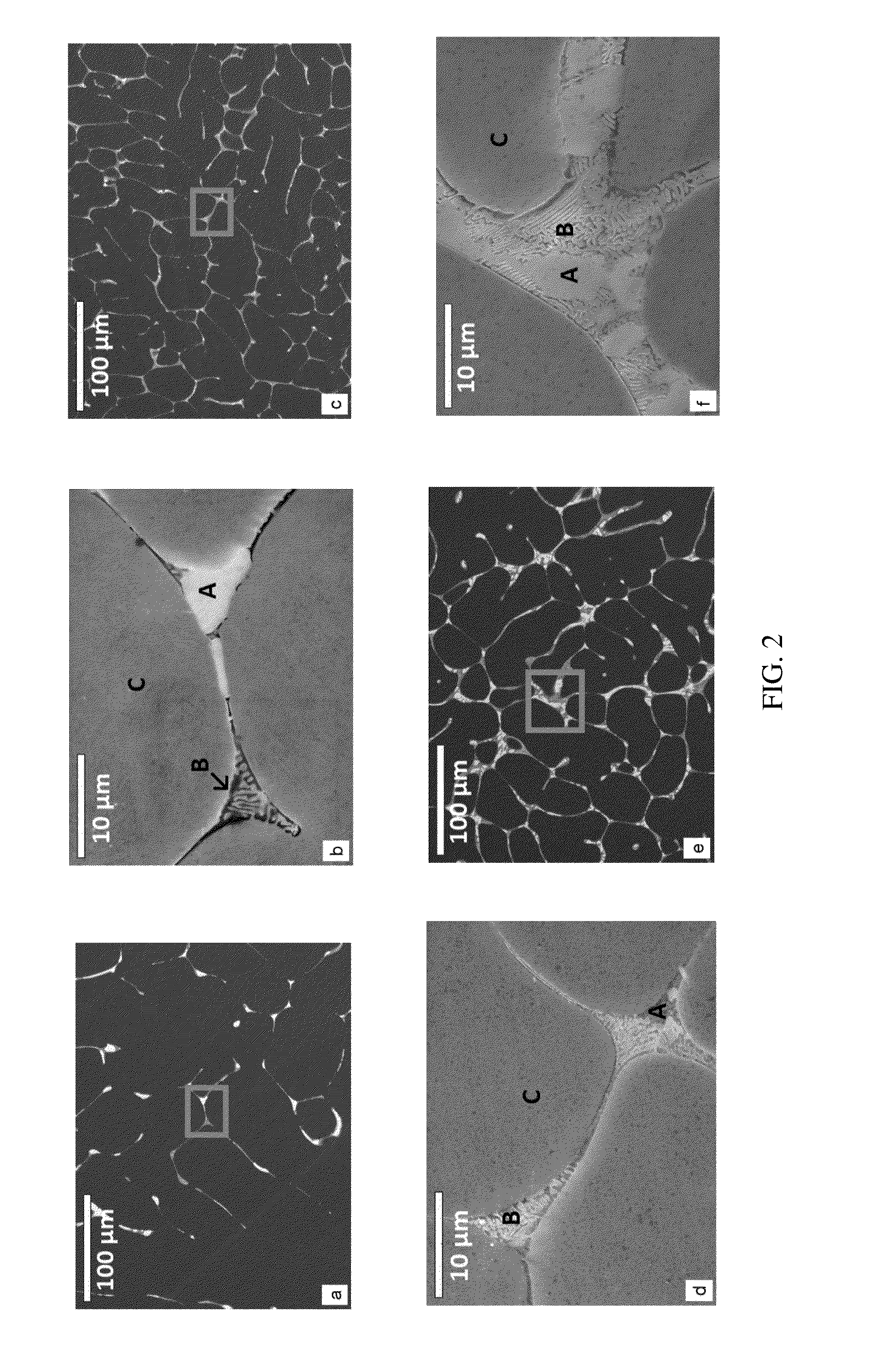 Bioresorbable metal alloy and implants made of same