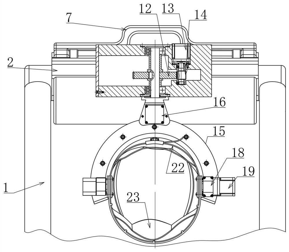 Intelligent angle-measurement multifunctional auxiliary treatment chair for cervical spondylosis