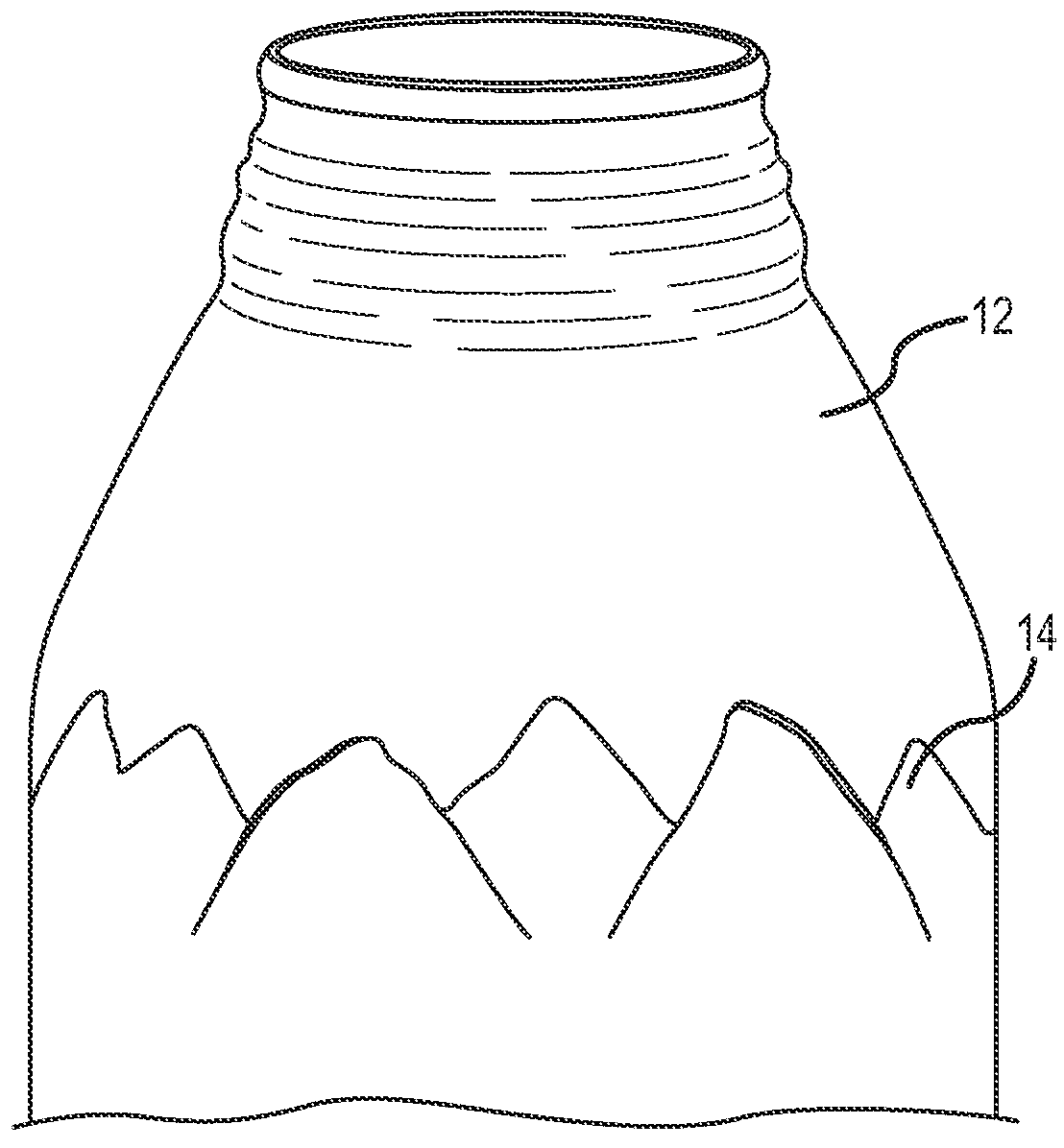 System for compression relief shaping