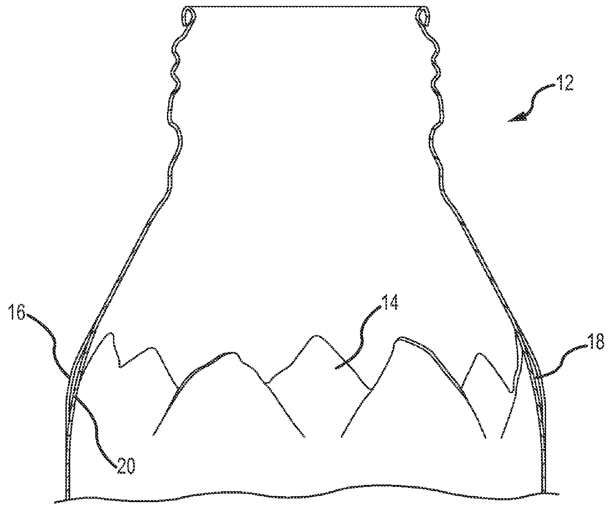 System for compression relief shaping