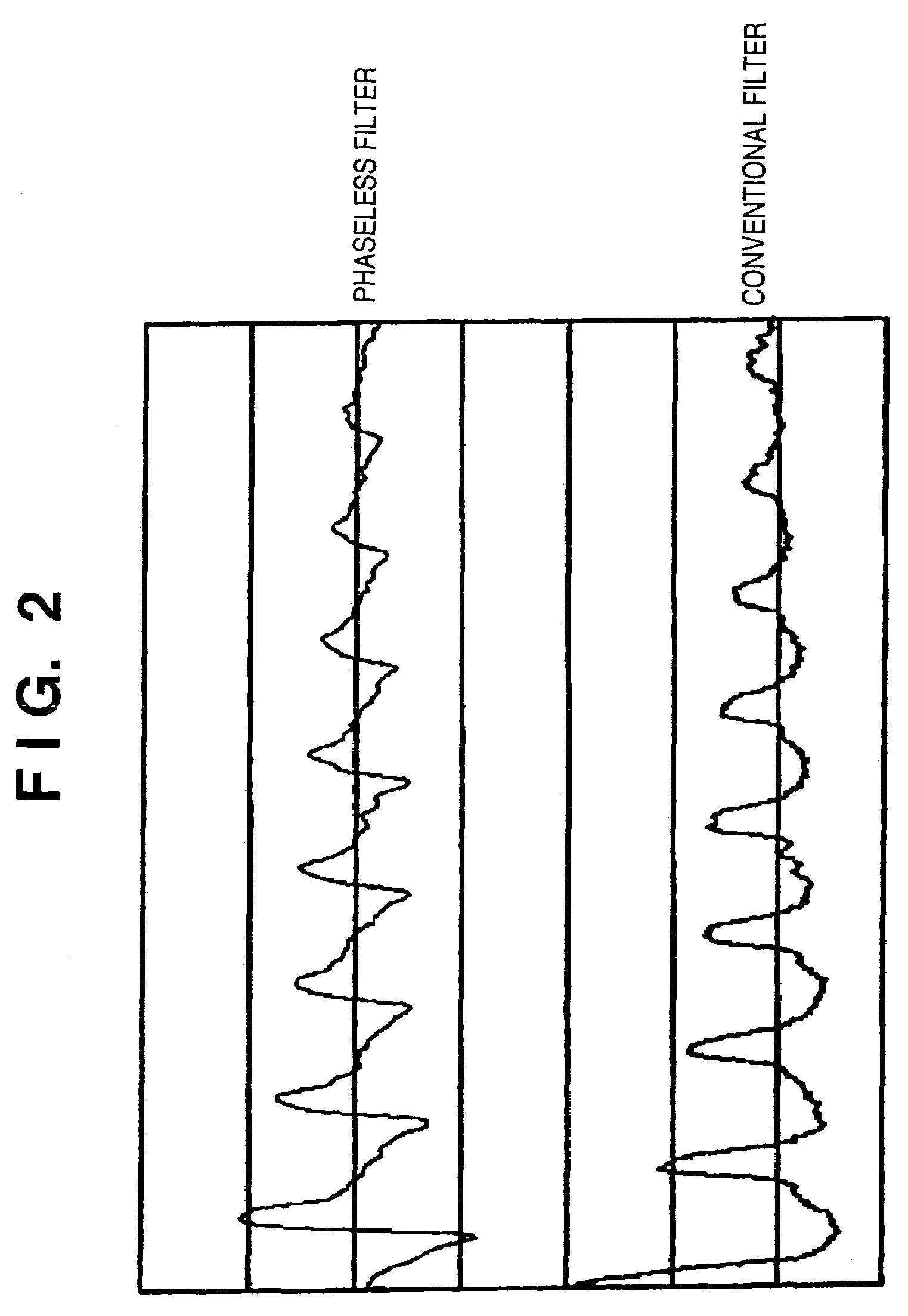 Blood pressure measuring apparatus