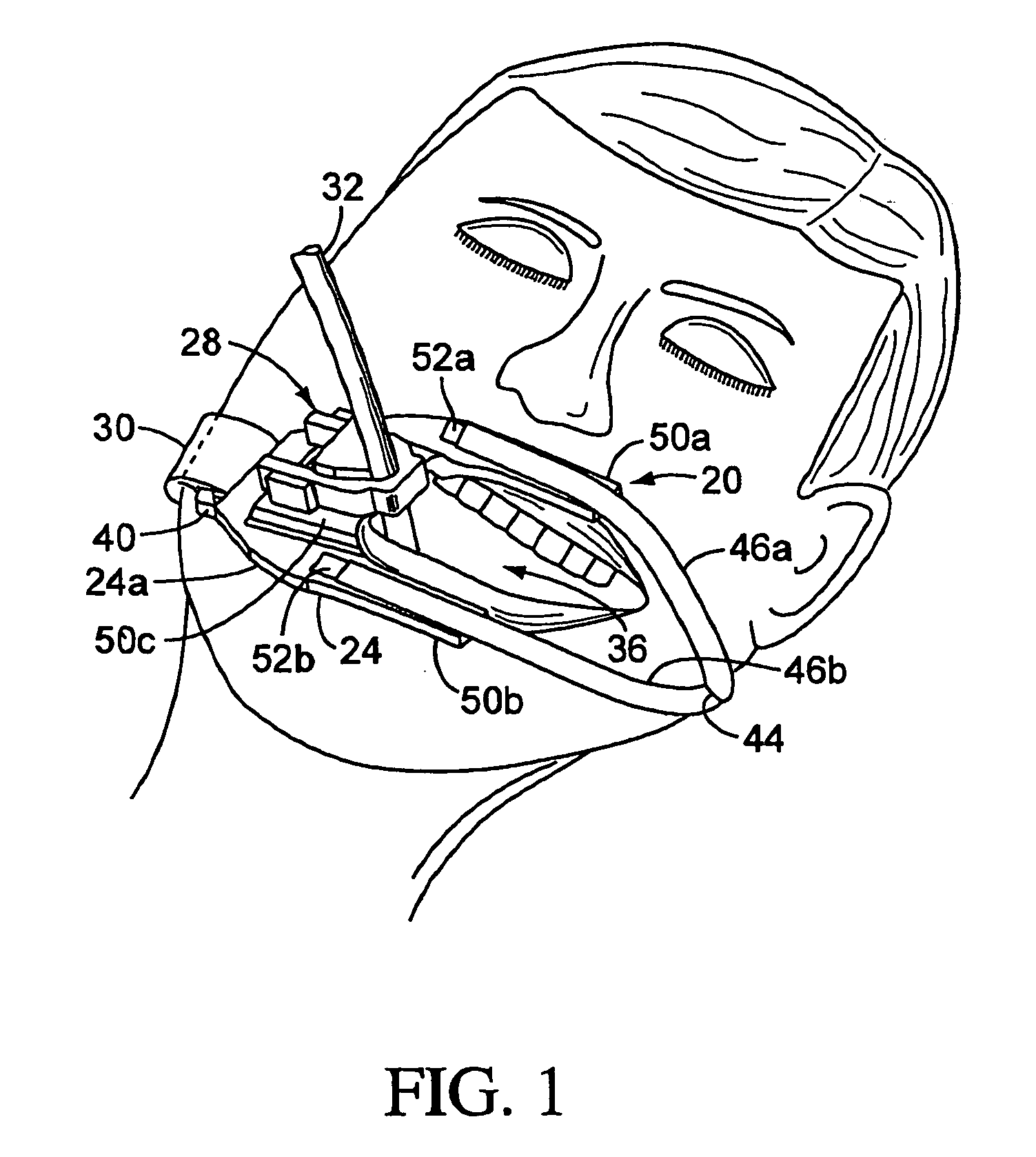 Endotracheal Tube Holder