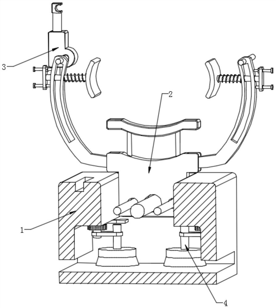 Orthopedic reduction fixing device