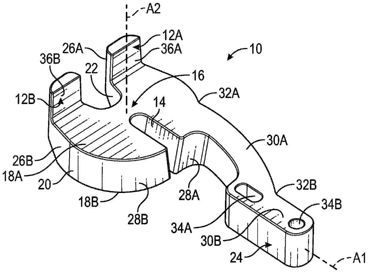 Prosthetic knee implant systems and methods with linked tibial rotation