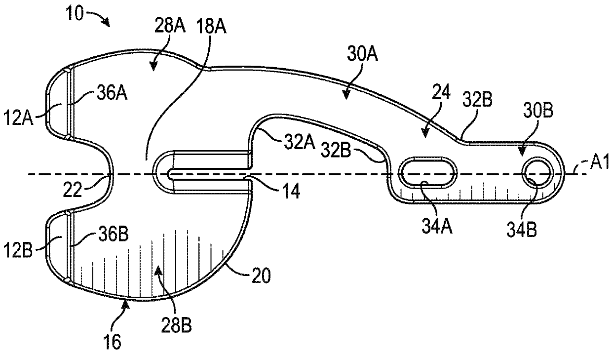 Prosthetic knee implant systems and methods with linked tibial rotation