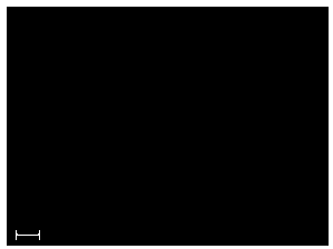 Mycoplasma hyorhinis virulent strain and application thereof