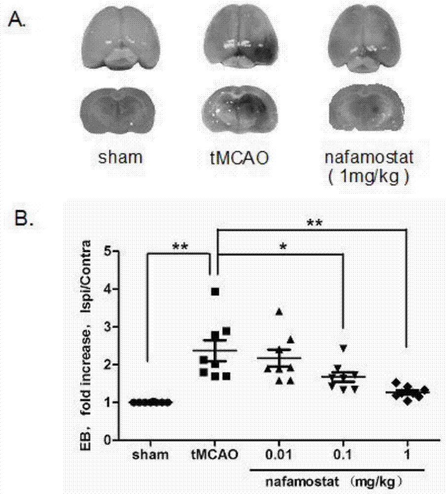 Application of nafamostat mesilate in preparation of neurological disease prevention and treatment medicines