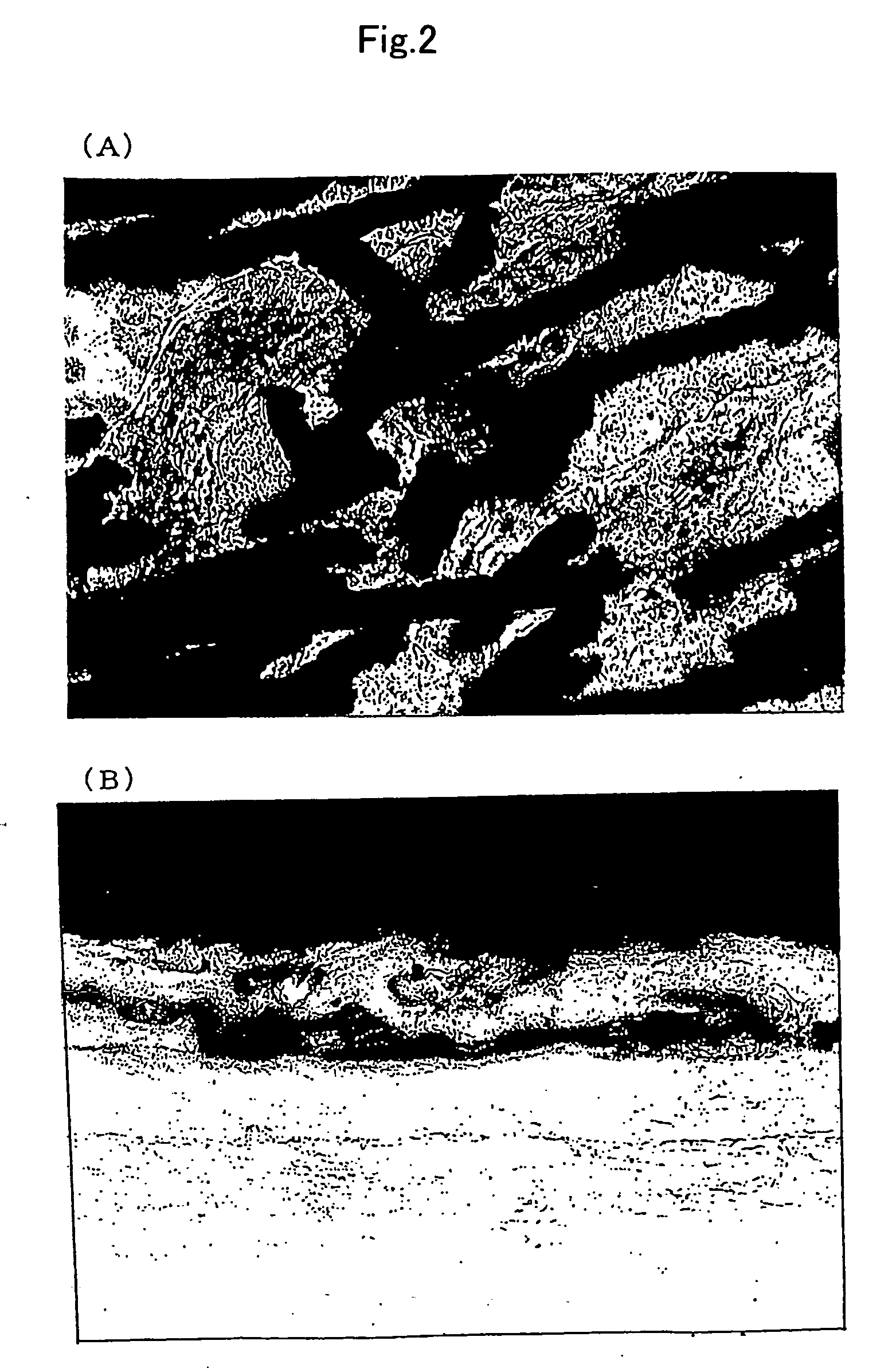 Medical material made of titianium fiber