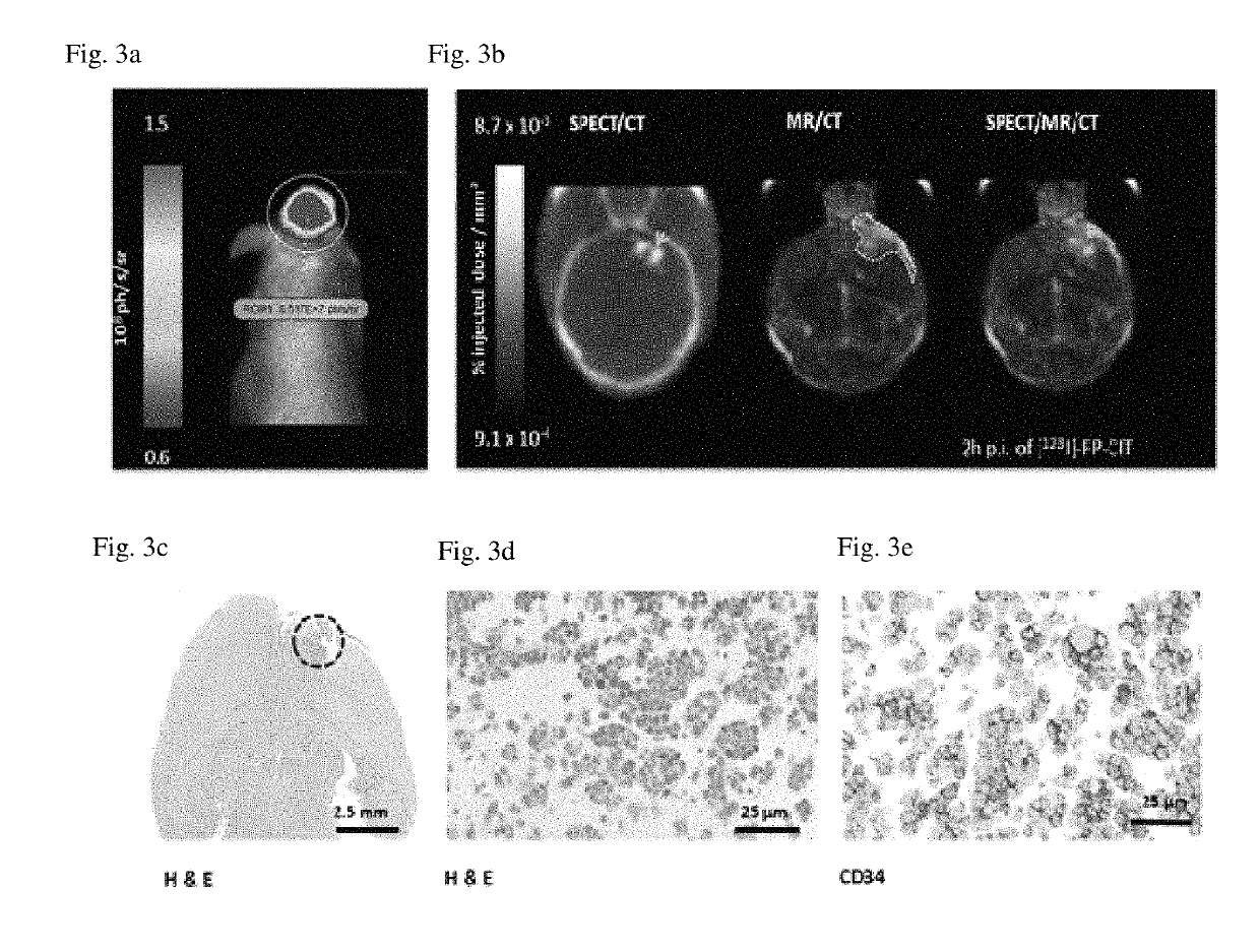 Detecting a therapeutic cell