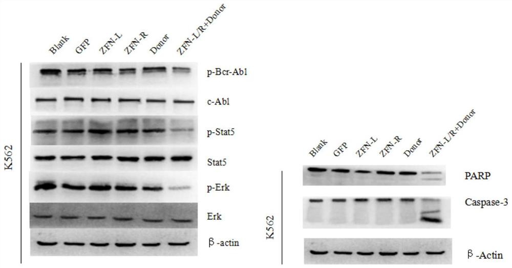 A zinc finger nuclease that inhibits the expression of human bcr-abl fusion gene or causes the function loss of human bcr-abl gene and its application