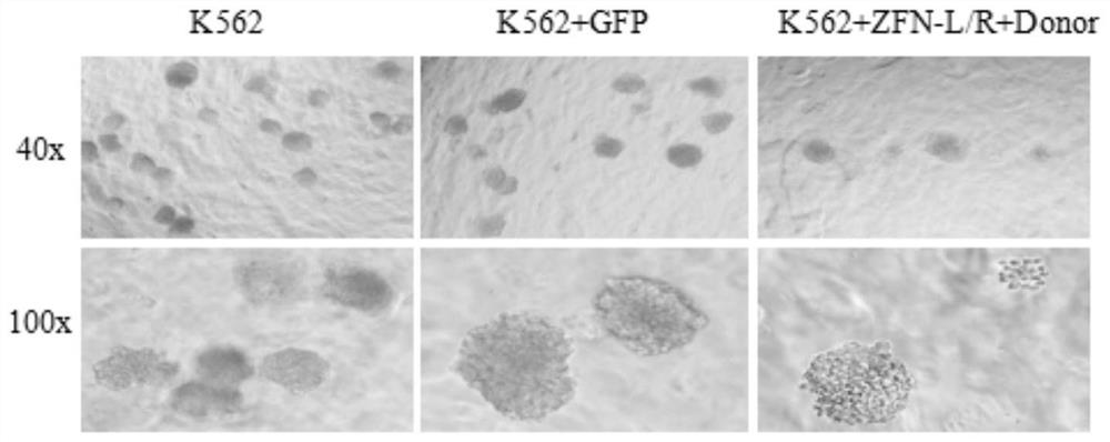 A zinc finger nuclease that inhibits the expression of human bcr-abl fusion gene or causes the function loss of human bcr-abl gene and its application