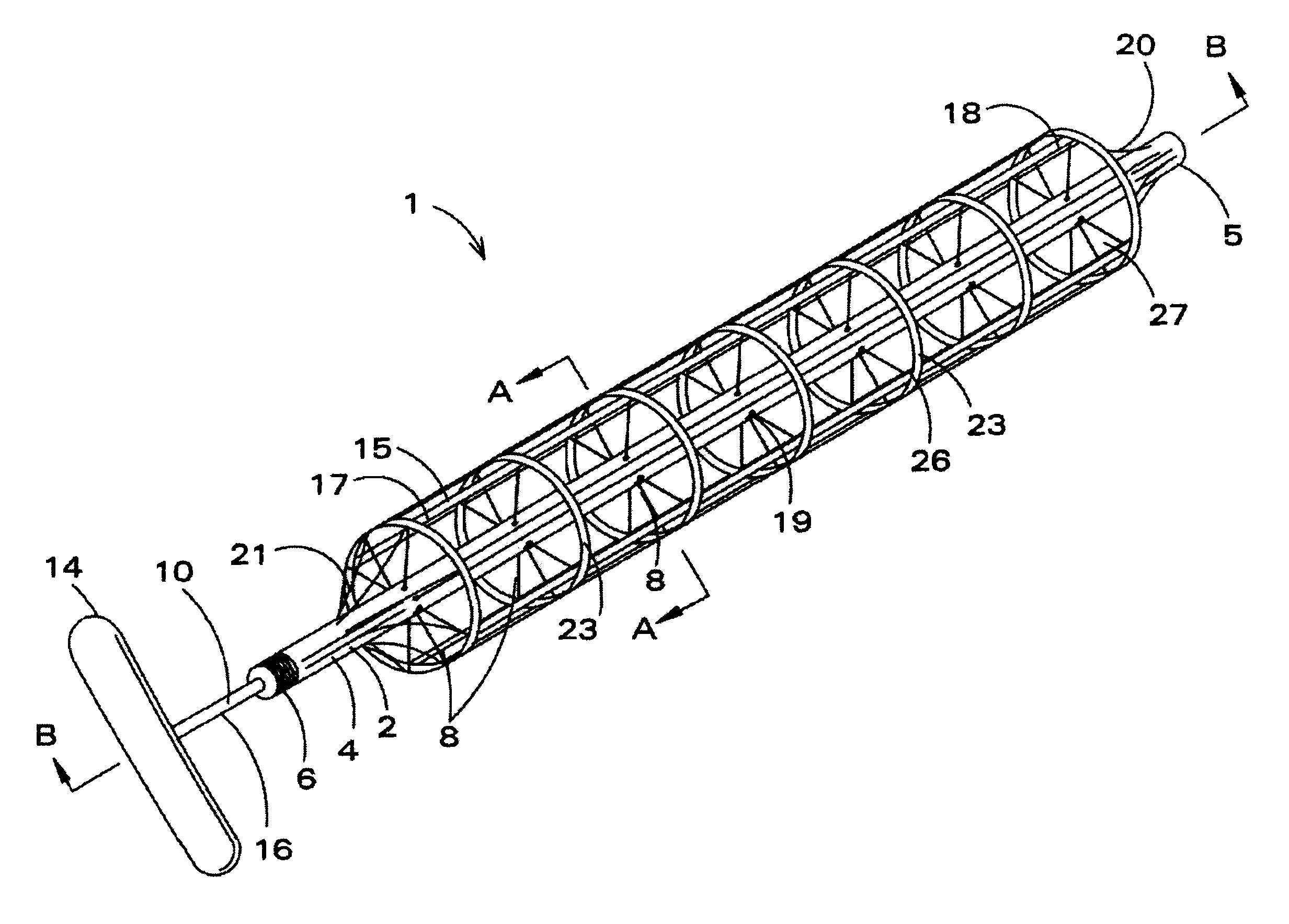 Mechanically deployable upper airway stent