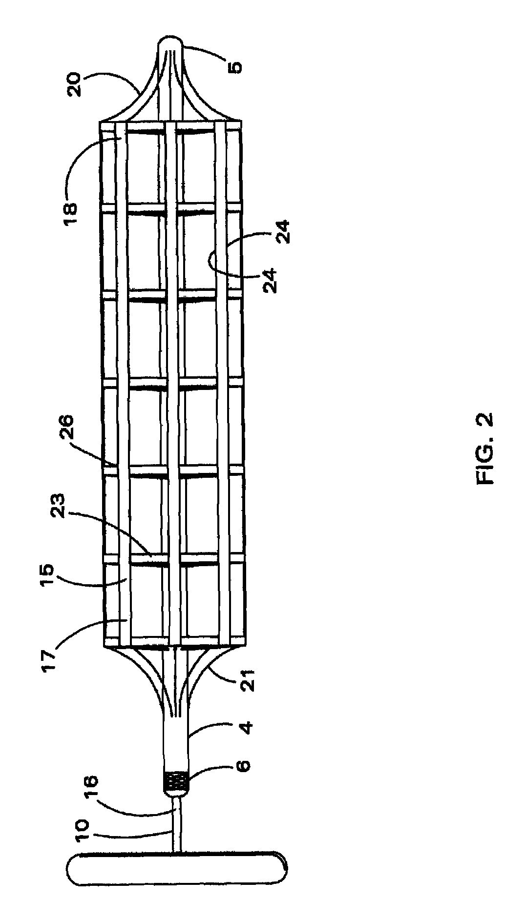 Mechanically deployable upper airway stent