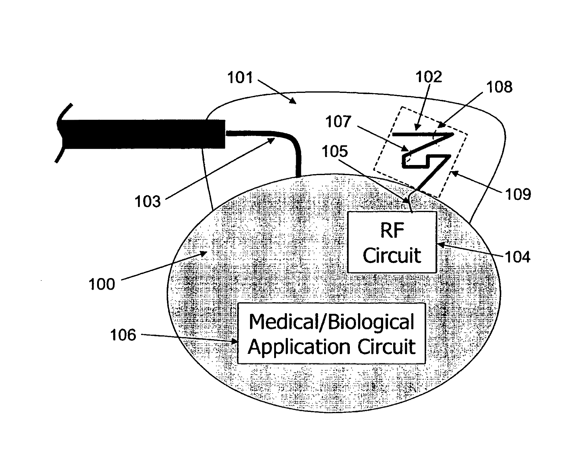 Wireless Implantable Medical Device