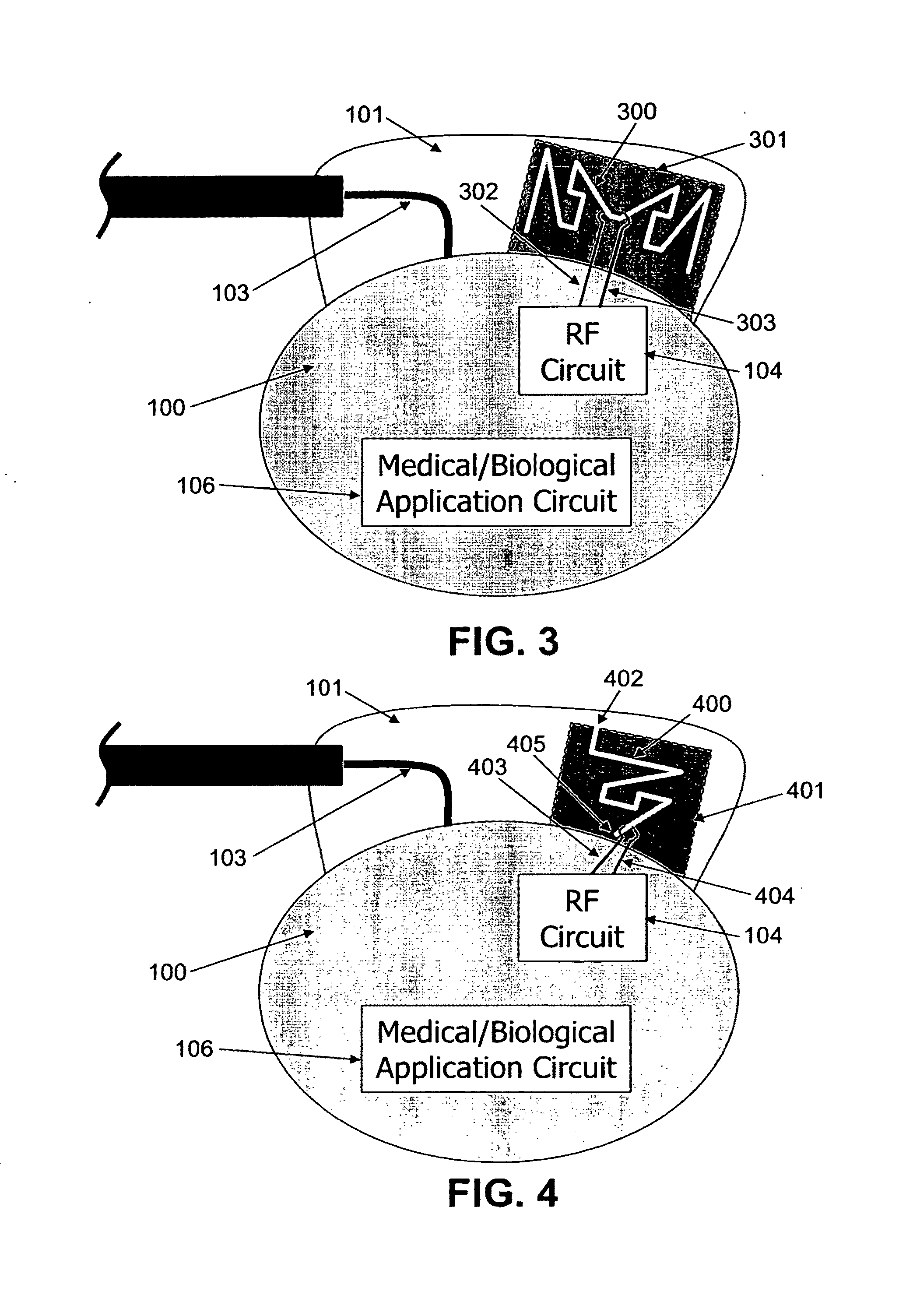 Wireless Implantable Medical Device