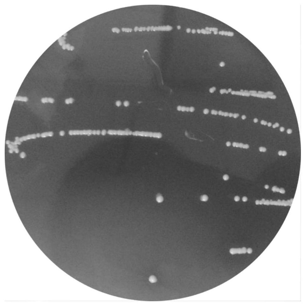 Bifidobacterium bifidum NX-7 and application of NX-7 in preparation of medicine for treating ischemic diseases