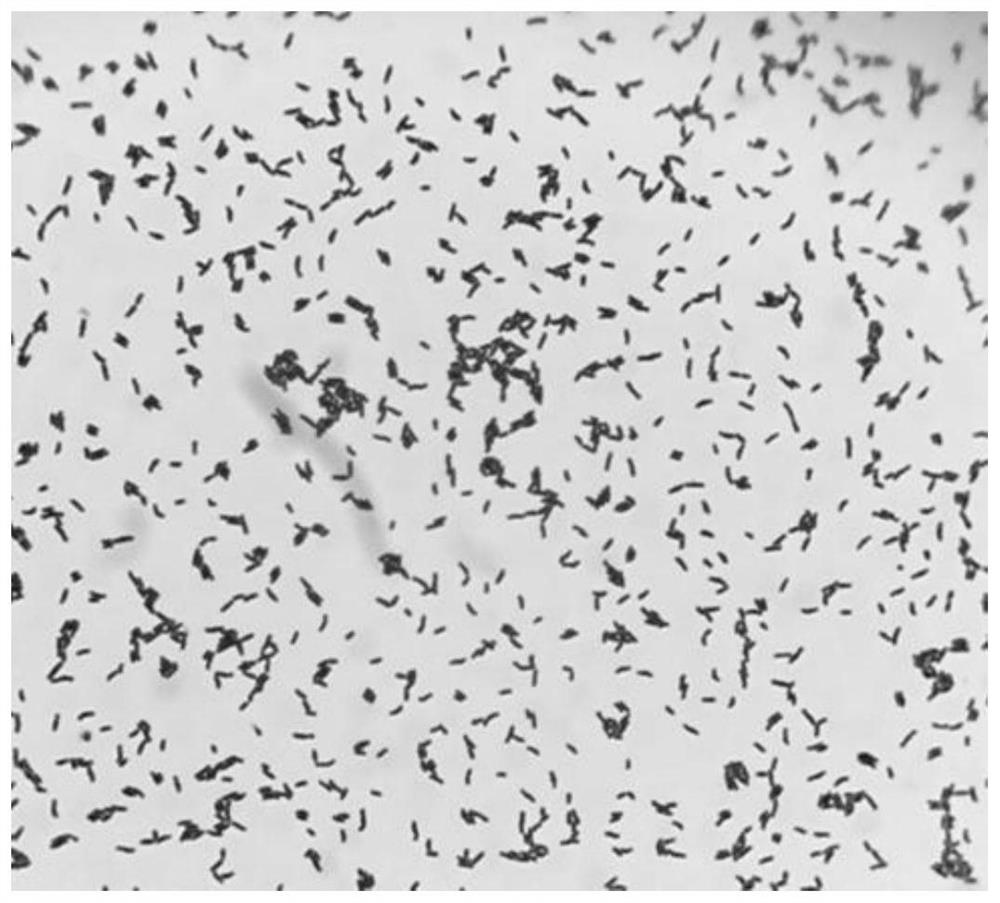 Bifidobacterium bifidum NX-7 and application of NX-7 in preparation of medicine for treating ischemic diseases