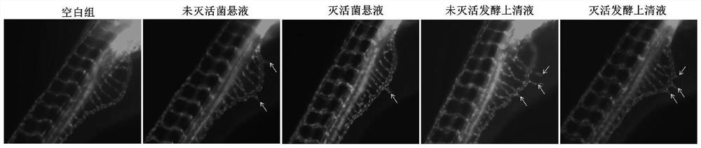 Bifidobacterium bifidum NX-7 and application of NX-7 in preparation of medicine for treating ischemic diseases