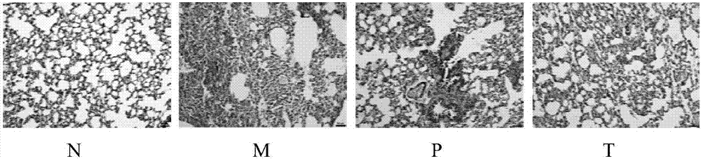 Applications of pseudolaric acid B in preparation of anti-pulmonary-fibrosis medicines