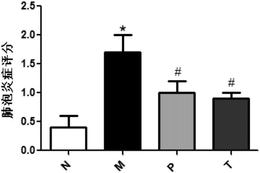 Applications of pseudolaric acid B in preparation of anti-pulmonary-fibrosis medicines