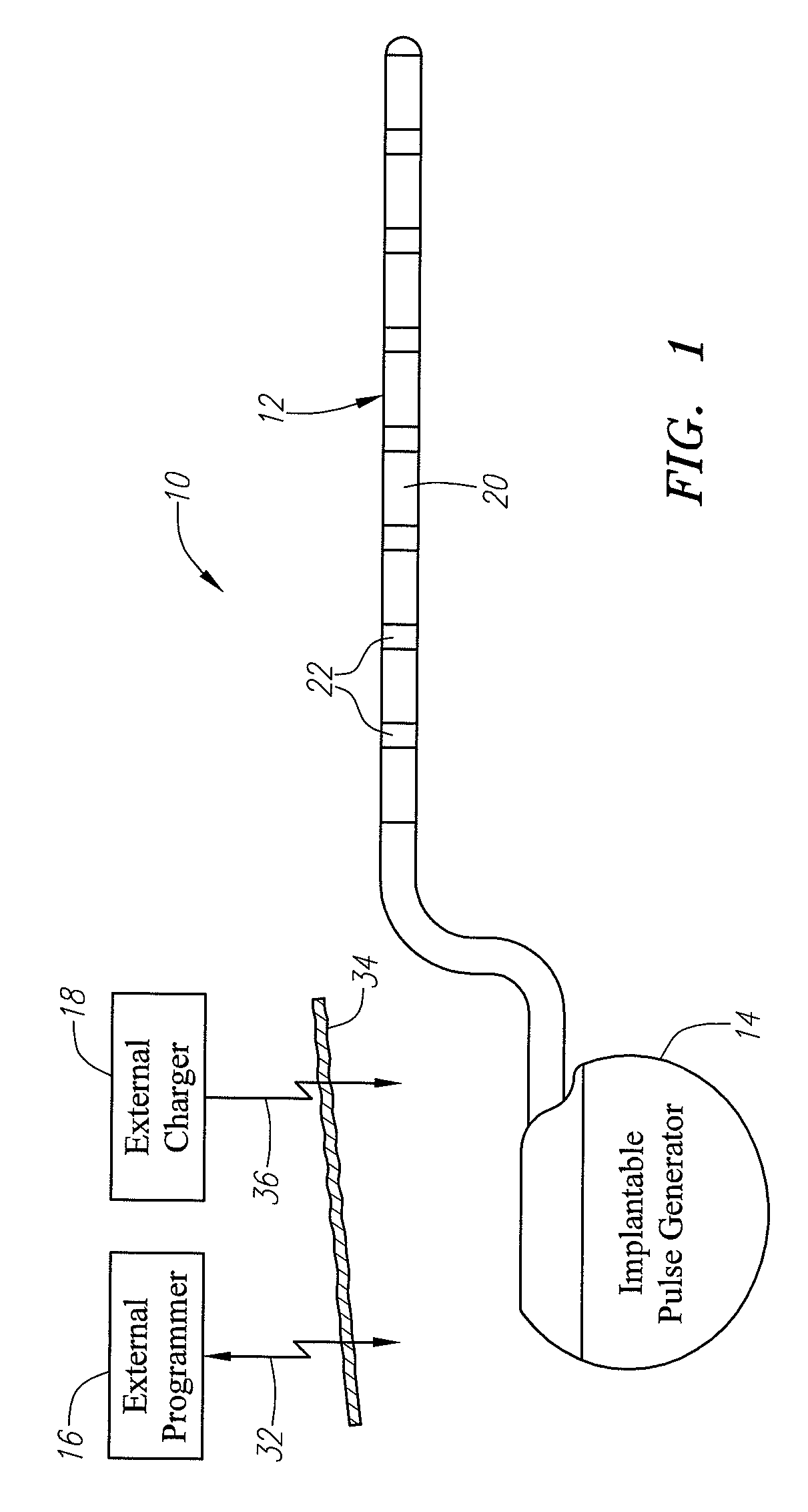 Charger alignment indicator with adjustable threshold