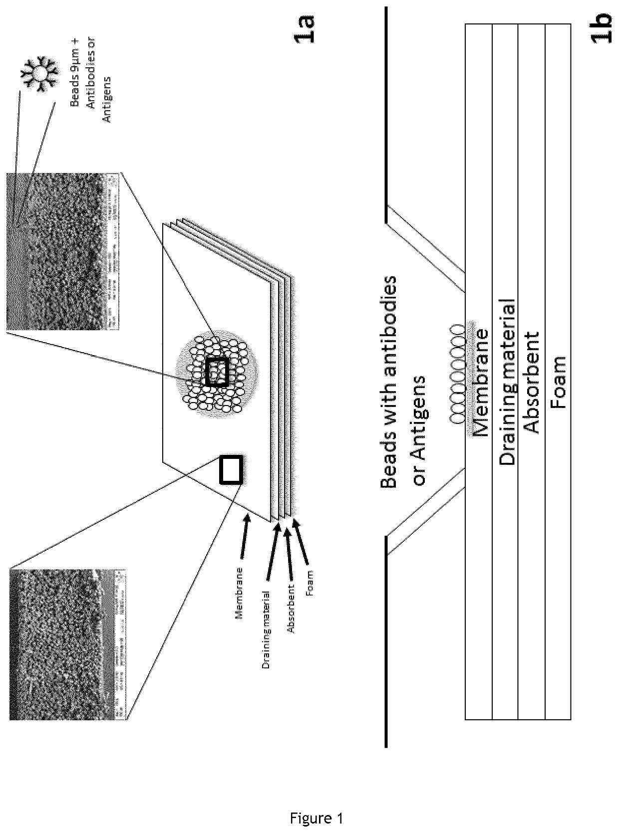 In vitro diagnosis device comprising beads and uses thereof