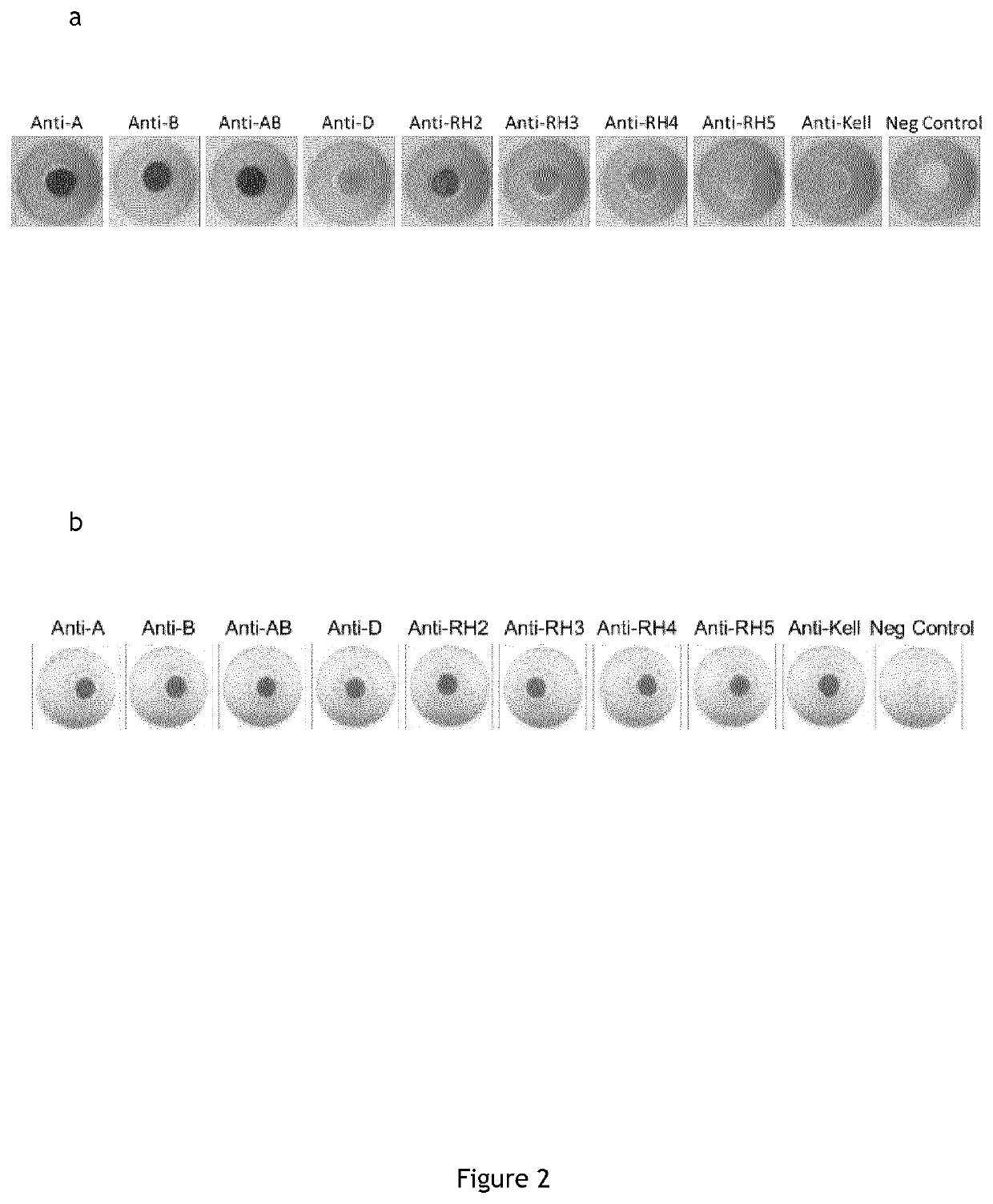 In vitro diagnosis device comprising beads and uses thereof