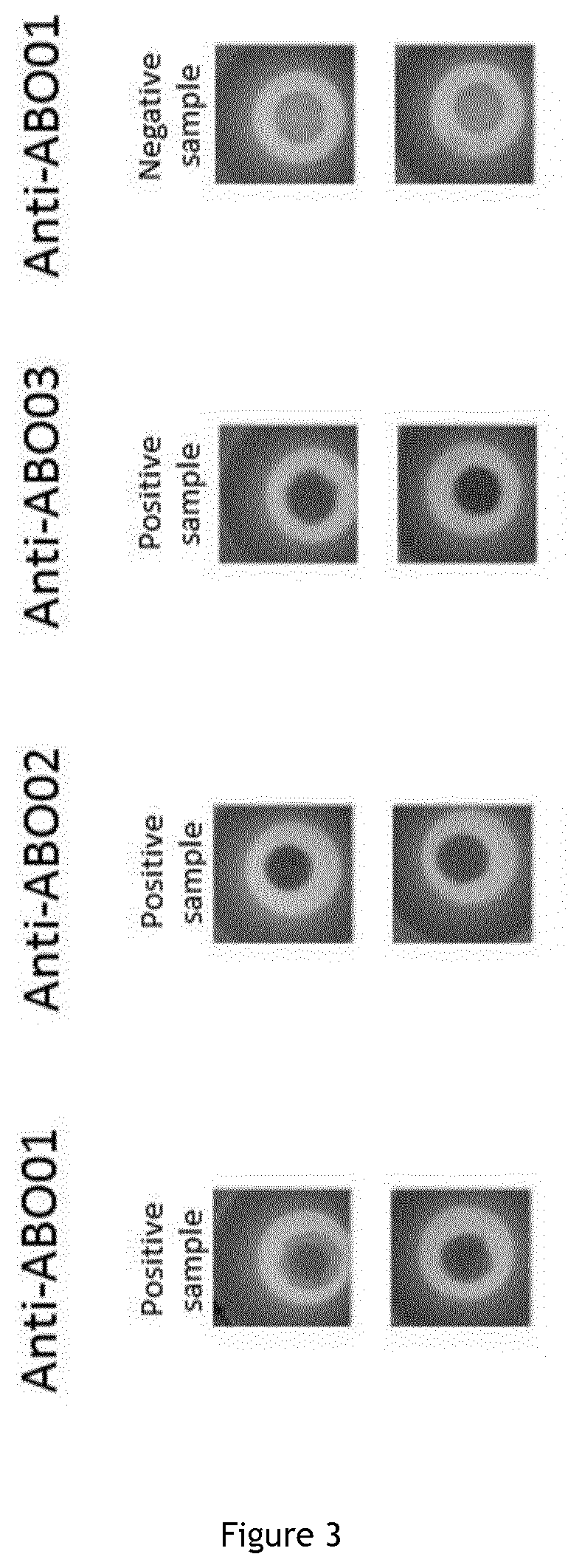 In vitro diagnosis device comprising beads and uses thereof