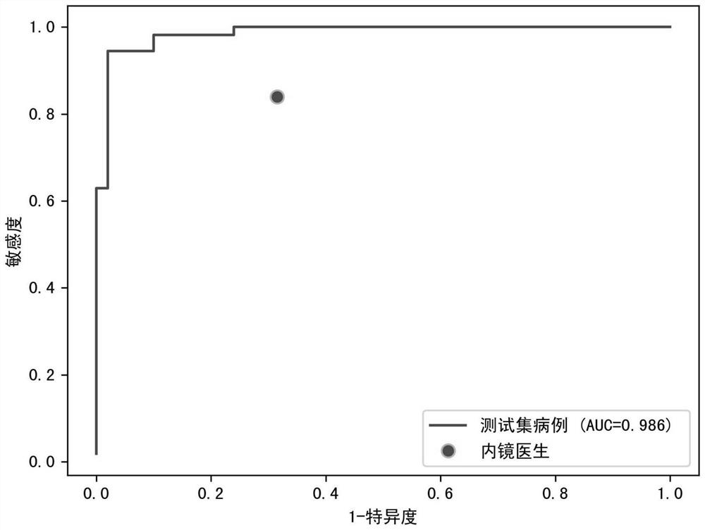 Ultrasonic endoscope, artificial intelligence auxiliary identification method and system, terminal and medium