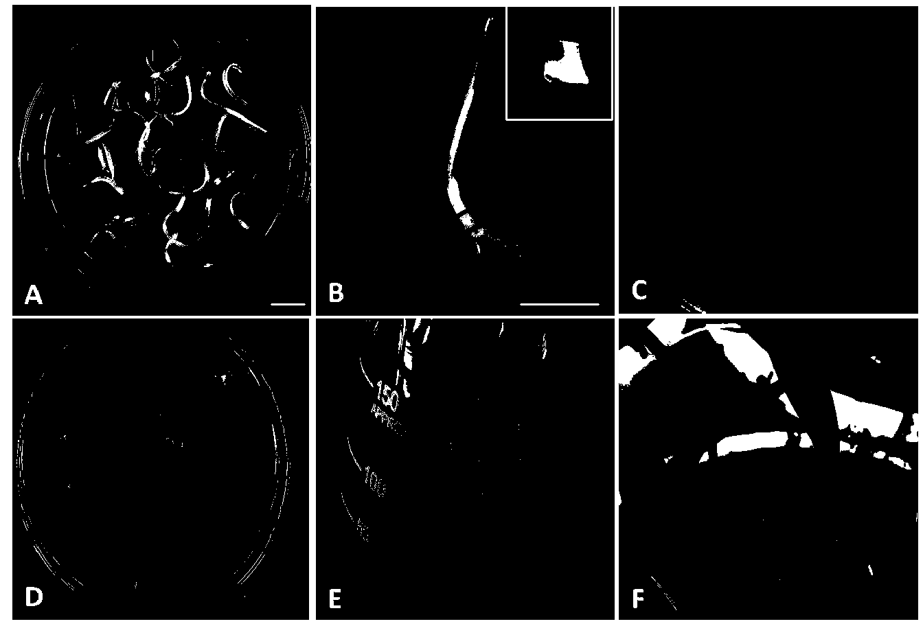 Agrobacterium tumefaciens-mediated barley leaf base transformation method