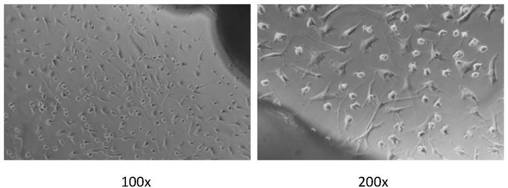 Human vestibular nerve tunica vaginalis immortalized cell line and construction method thereof