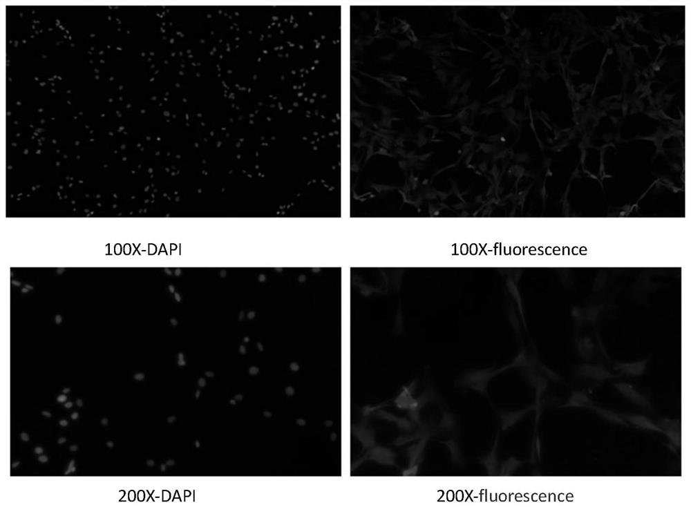 Human vestibular nerve tunica vaginalis immortalized cell line and construction method thereof