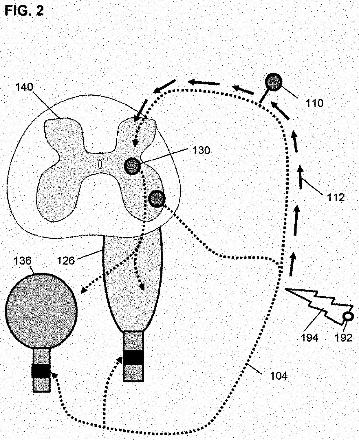 Method of treating voiding dysfunction