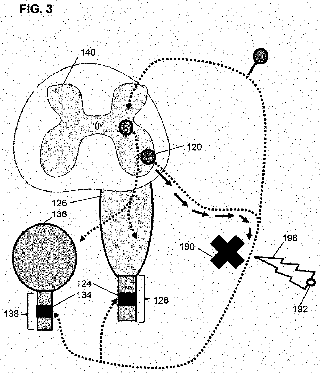 Method of treating voiding dysfunction