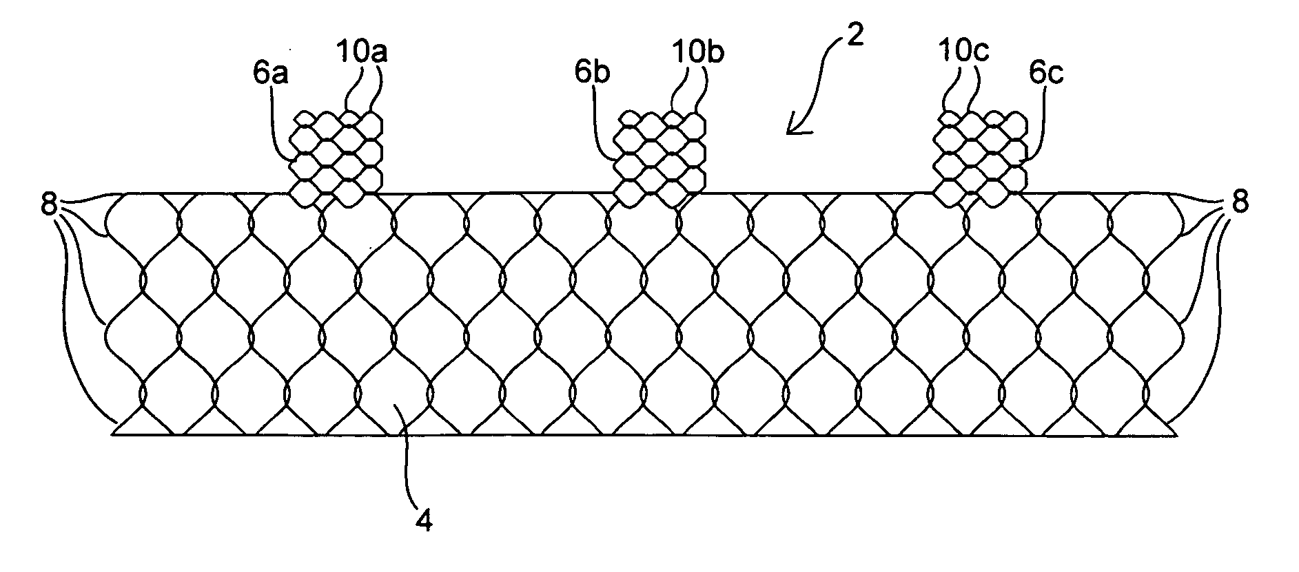 Apparatus and method for deploying an implantable device within the body