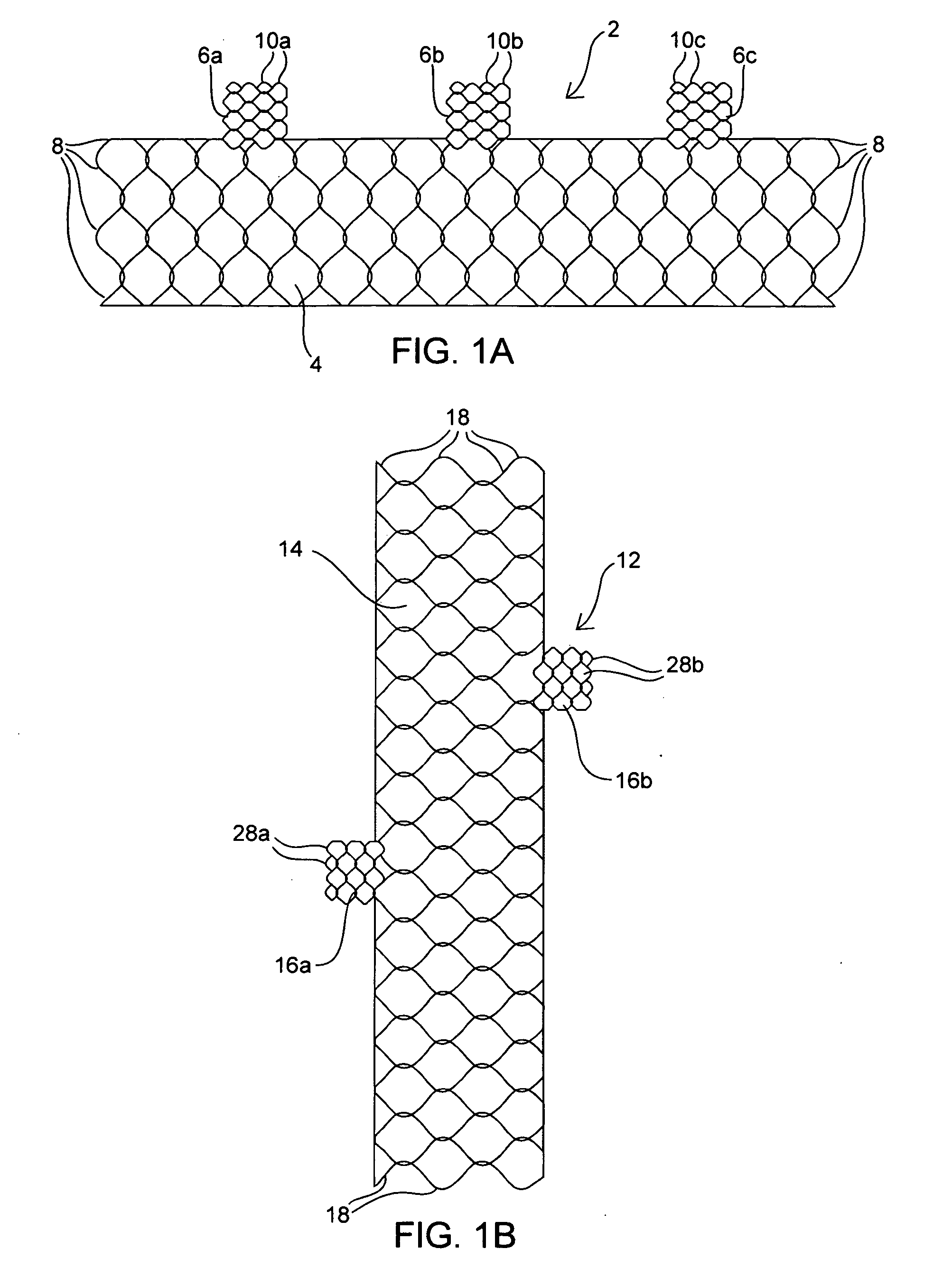 Apparatus and method for deploying an implantable device within the body