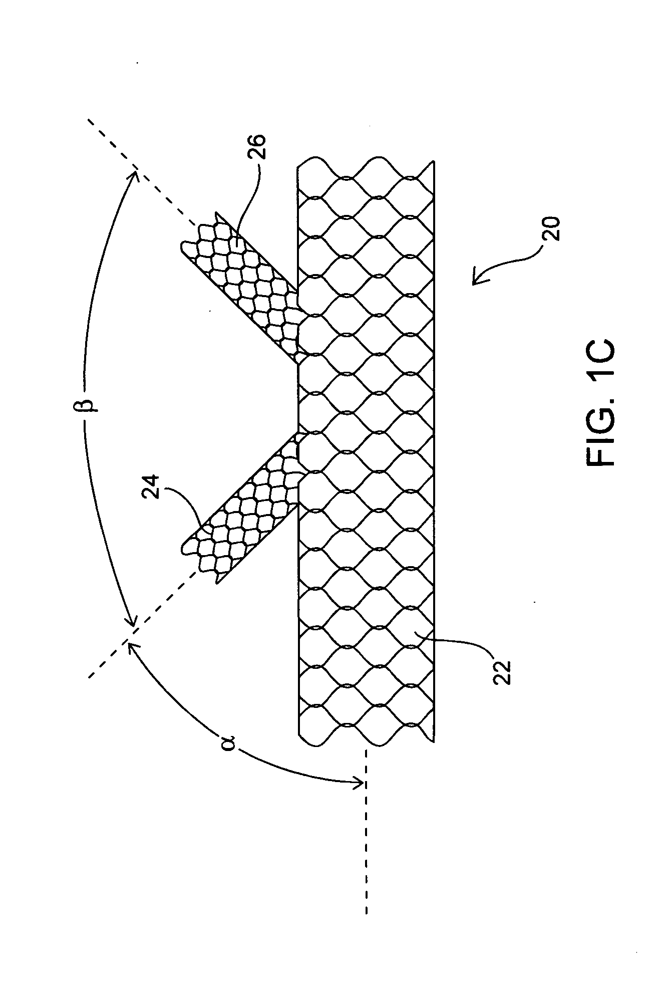 Apparatus and method for deploying an implantable device within the body