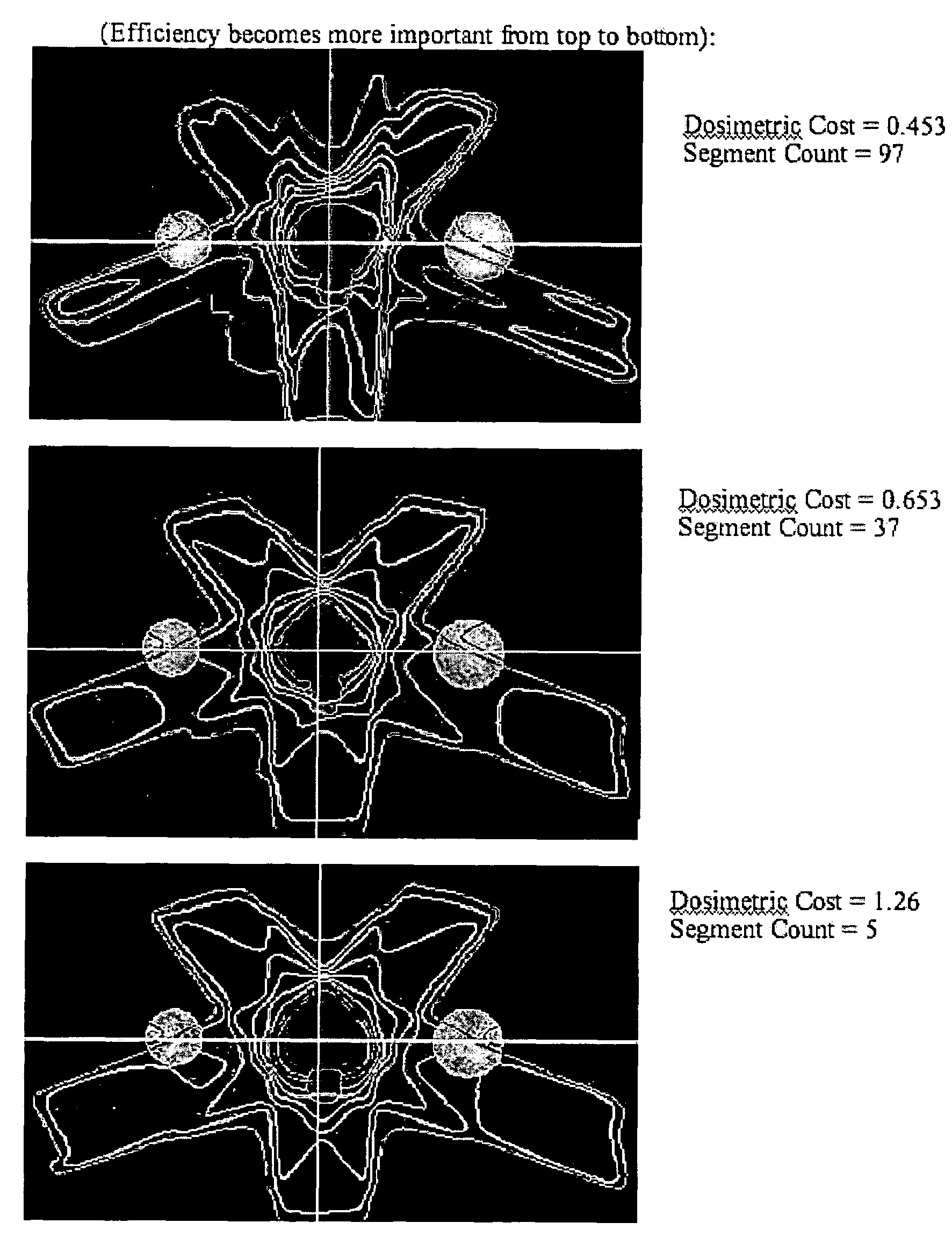 Planning method for radiation therapy