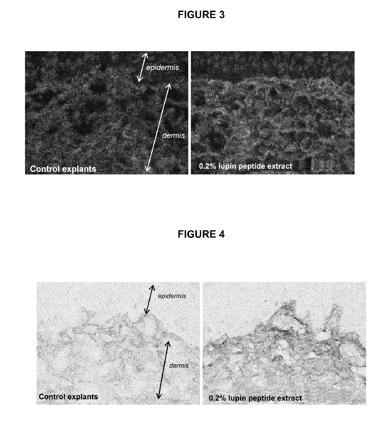 Lupin peptide extracts and skin firmness