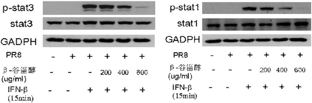 Application of beta-sitosterol to preparation of medicine for treating or preventing influenza A