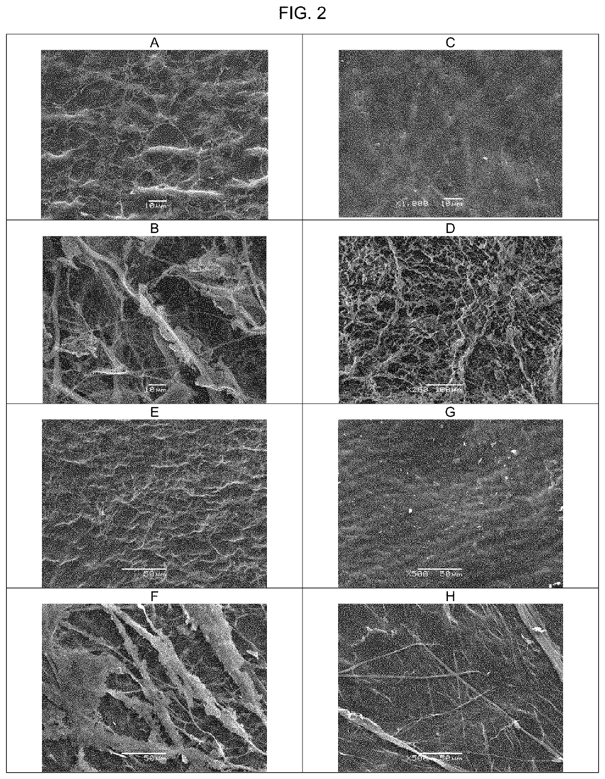 Decellularization method