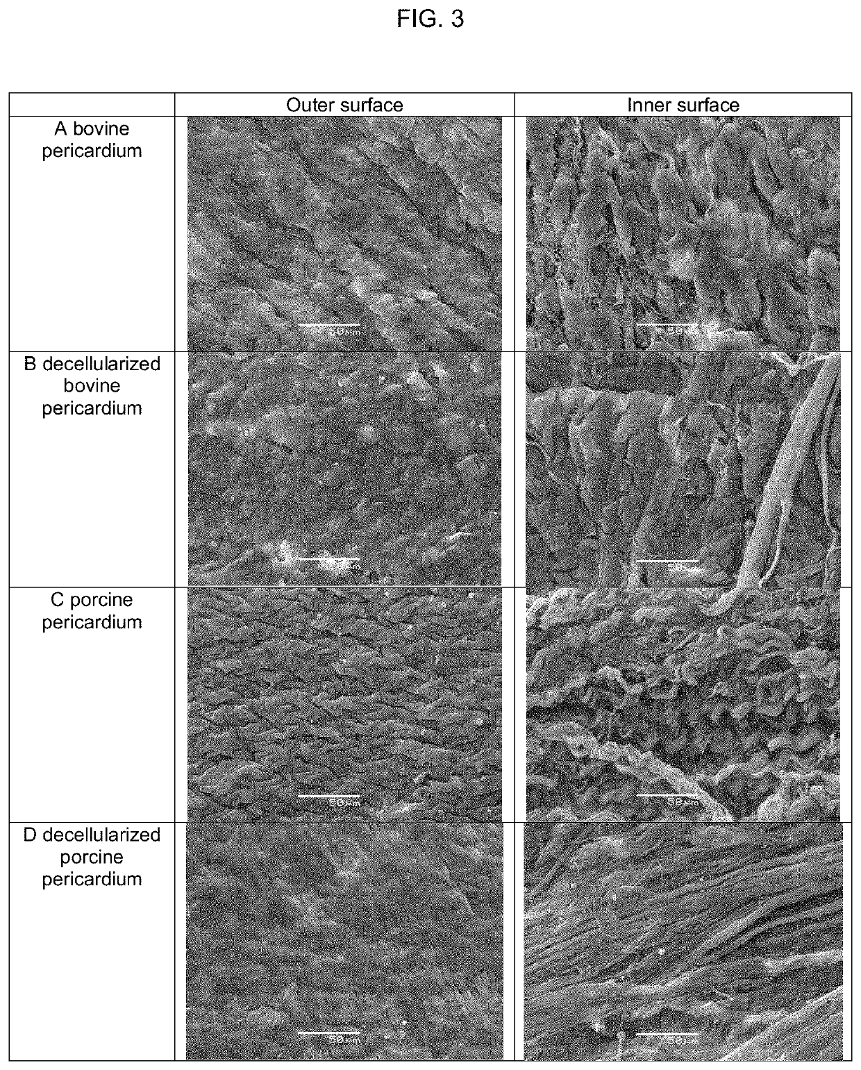 Decellularization method