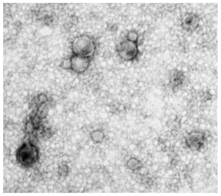 Bovine placenta cell exosome freeze-dried powder and preparation method thereof