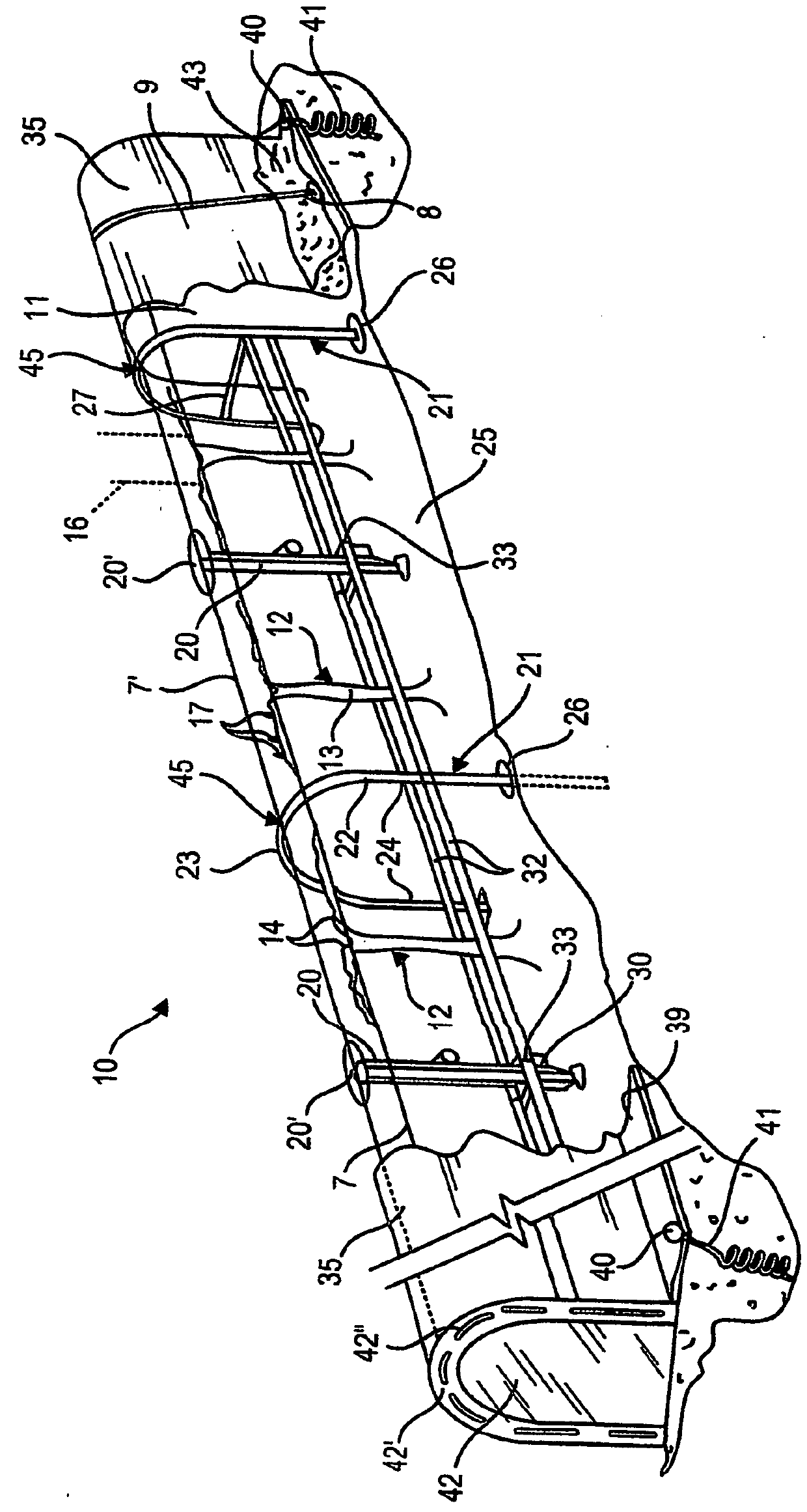 Method and system for increasing days for the cultivation of particular fruit bearing vines in unfavourable climatic regions