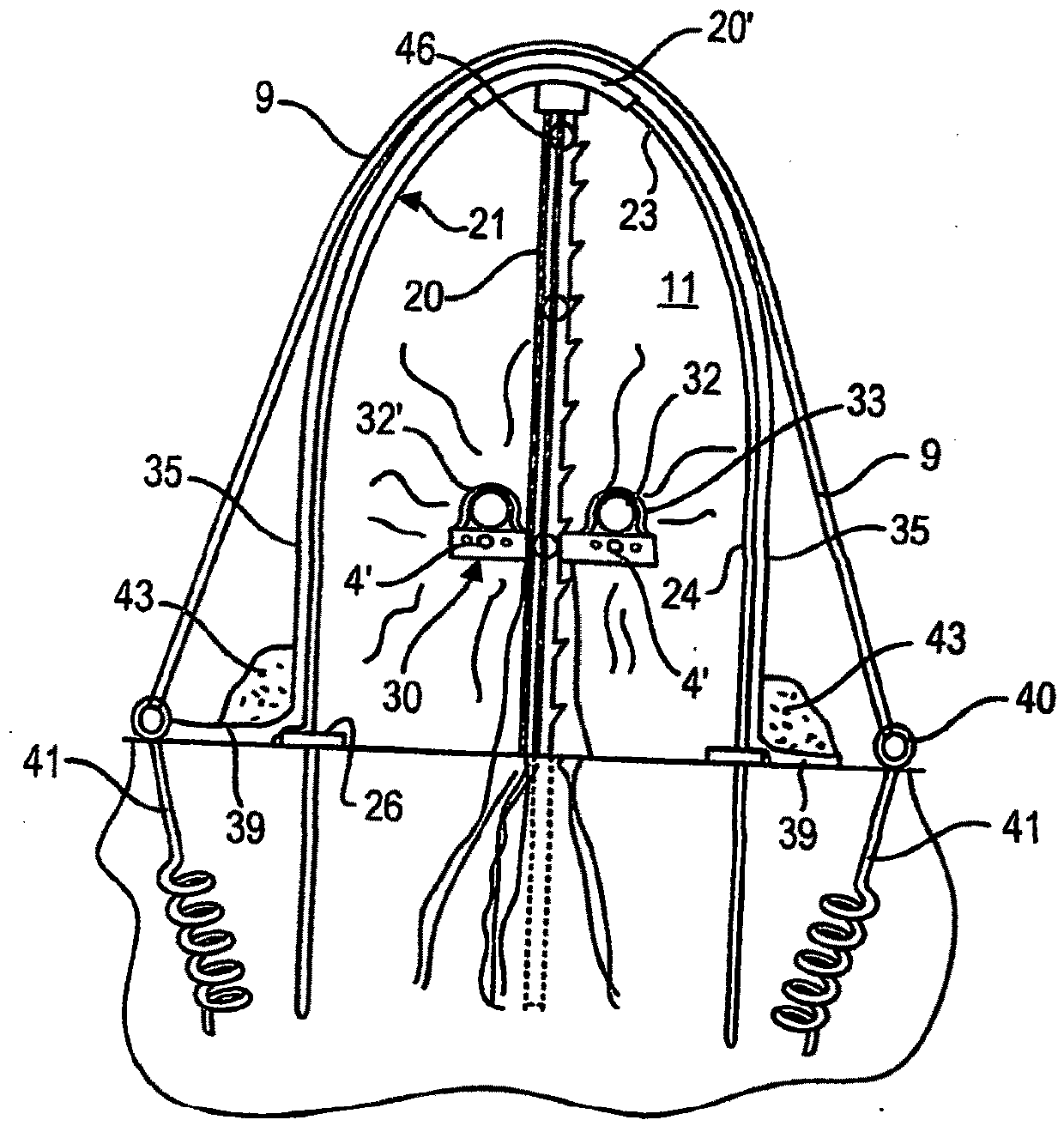 Method and system for increasing days for the cultivation of particular fruit bearing vines in unfavourable climatic regions