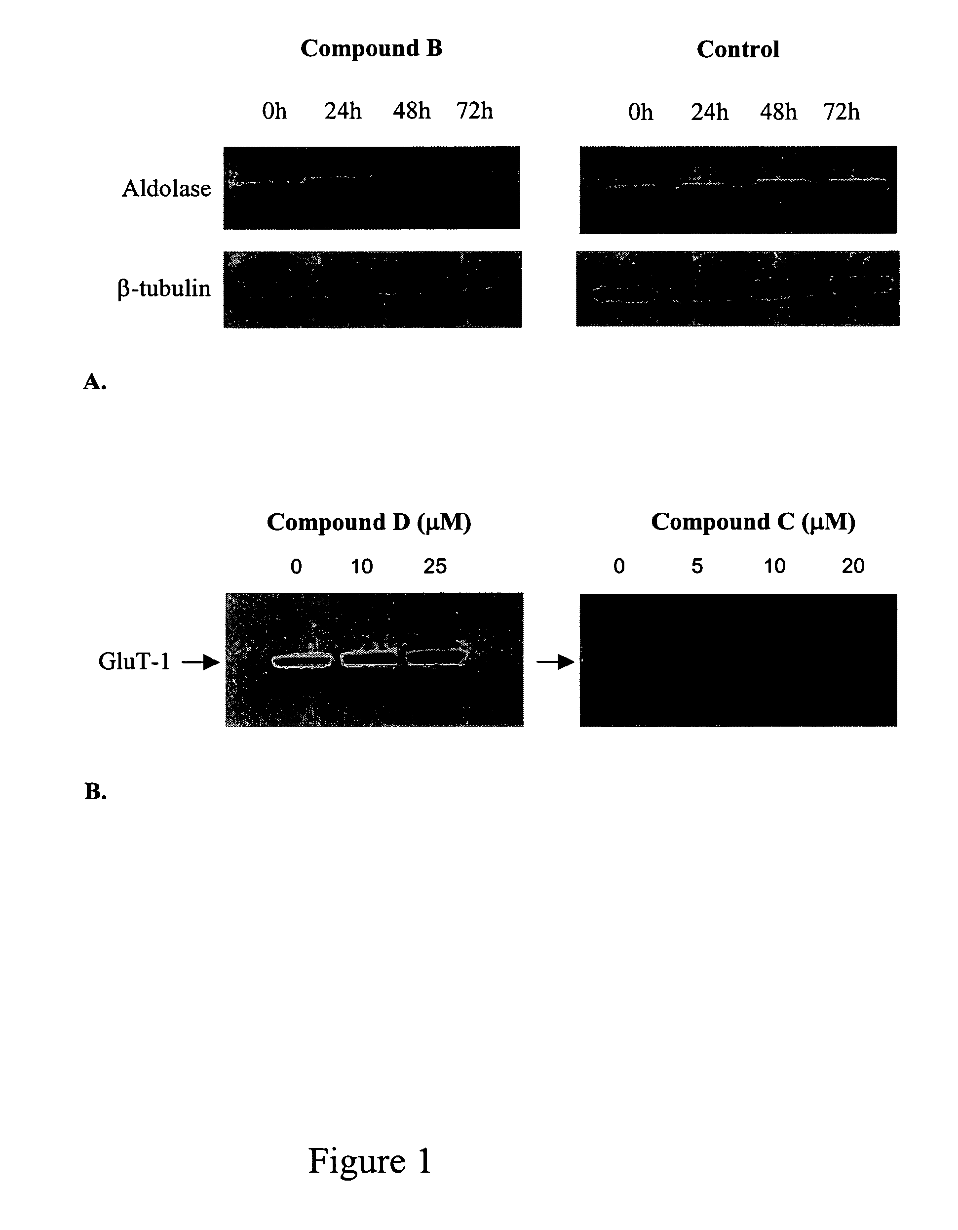 Treatment of diabetes