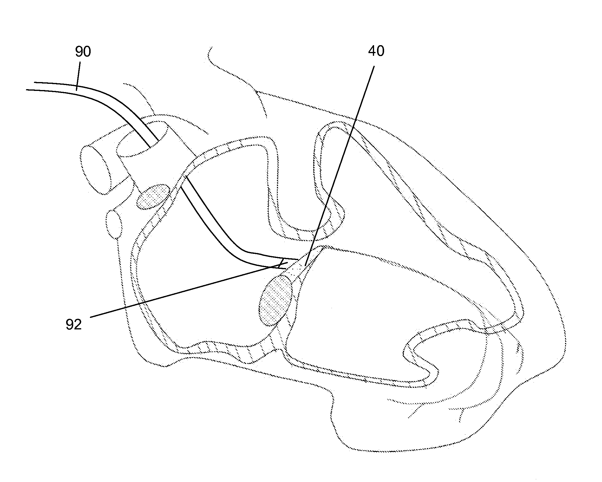 Generation of biological pacemaker activity