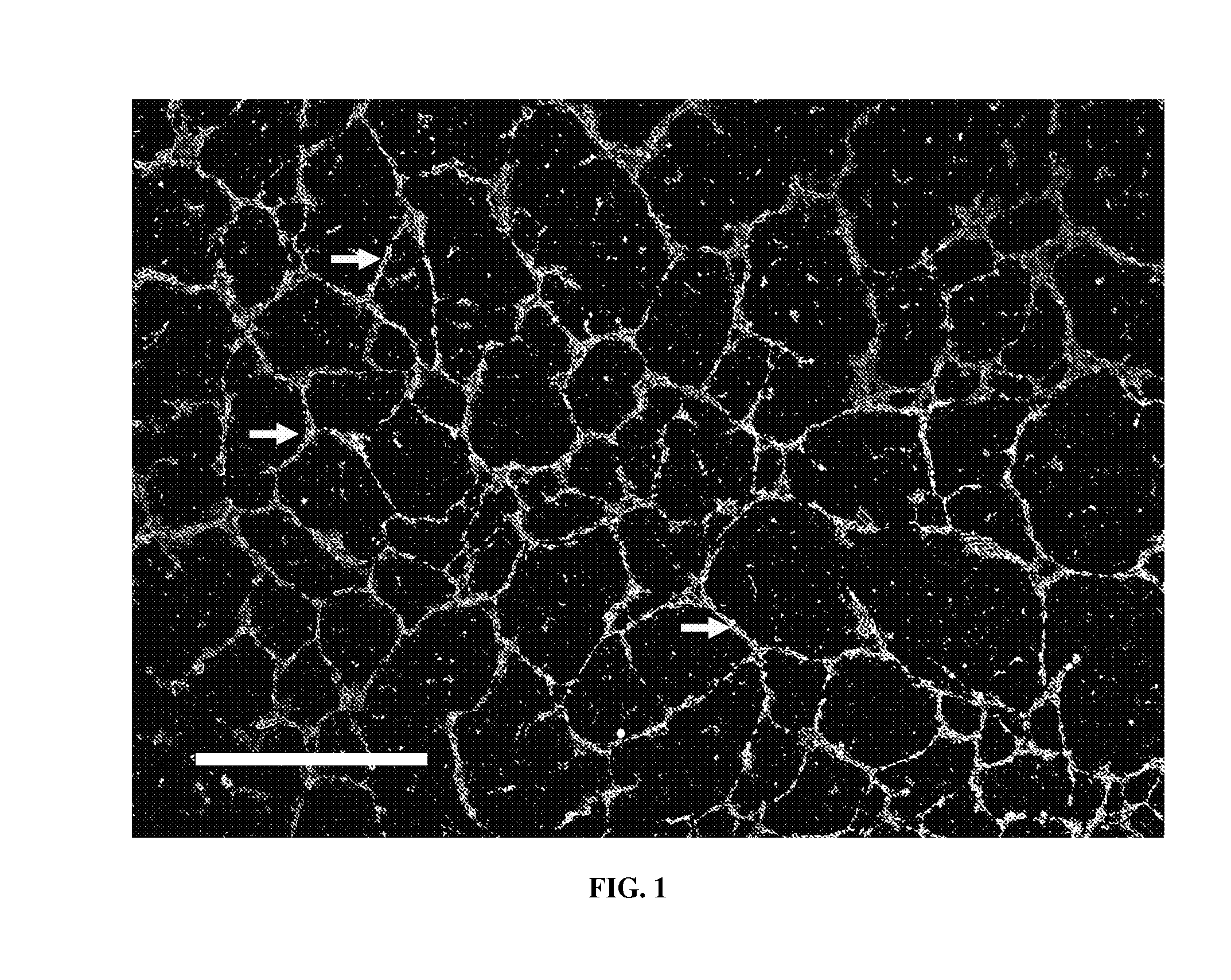 Engineered lumenized vascular networks and support matrix