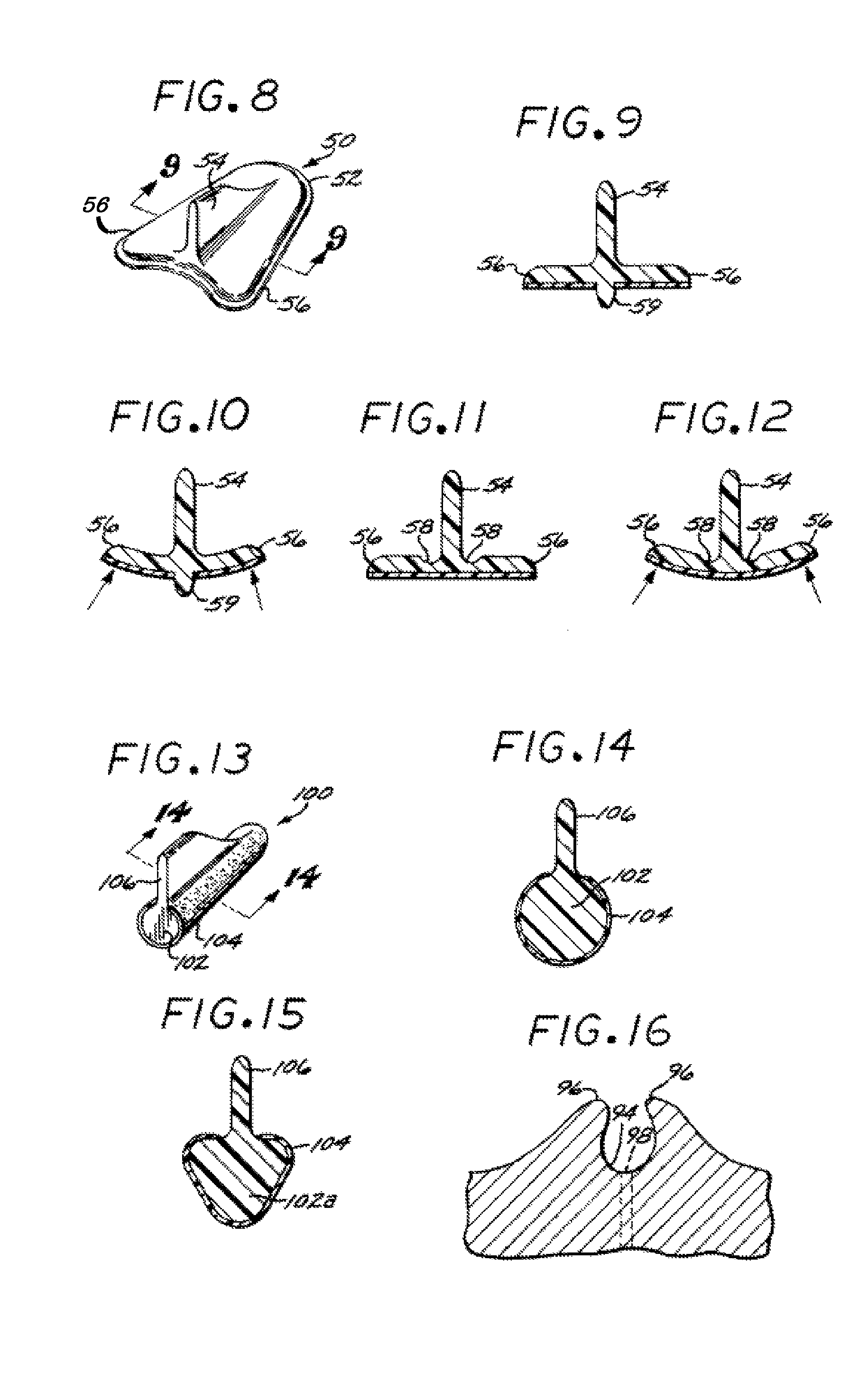 Systems and methods for incontinence control